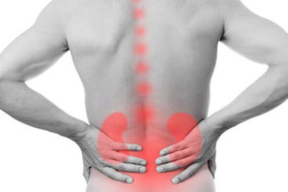 Kidney disease can cause low back pain