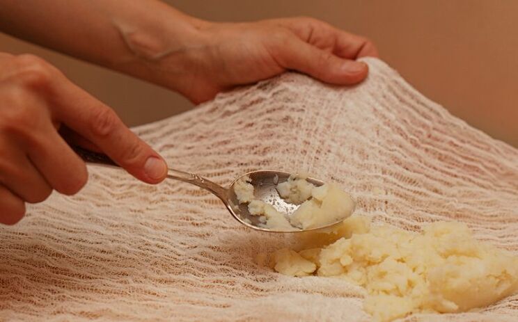 Prepare compression with potatoes