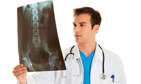 Doctor looking at x-ray to diagnose low back pain